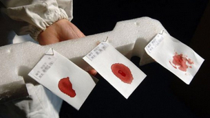 ������Ѫ�͜yԇ��ͨ�^��Ѫ�͵ęz�Ȍ����_�H���P(gu��n)ϵ������(j��)19���o(j��)ĩ���_�J(r��n)���ϵ ��z���������˂��J(r��n)�R�����Ѫ���ǰ����z�����������һ������һ��Ѫ�͵ĸ�ĸ������ŮҲ��������(y��ng)��Ѫ�����@��Ѫ���b���H���P(gu��n)ϵ�춨�˻��A(ch��)����ʮ���o(j��)��ʮ������˂��l(f��)�F(xi��n)�����ð�Ѫ��(x��)���Ŀ�ԭ���M���H���b������(zh��n)�_�Կ��_(d��)80%���ٽY(ji��)��Ѫ�͙z򞣬���_(d��)���^�ߵĜ�(zh��n)�_�̶��� ������Ⱦɫ�w���B(t��i)�ԡ�20���o(j��)80������t(y��)�W(xu��)�҂����_��(chu��ng)��ʹ��Ⱦɫ�w���B(t��i)���b���H���P(gu��n)ϵ�ļ��g(sh��)��Ⱦɫ�w���B(t��i)���ַQ���B(t��i)�ԣ�heteromorphism������ָ������Ⱥ�г�Ҋ�ĸ��NȾɫ�w�ΑB(t��i)��΢С׃�����磺�S�w�������؏�(f��)��ȱ�����������^(q��)�ğɹ⏊��׃���ȣ����@�N���B(t��i)�ǿ����z�������@헼��g(sh��)�����������ΑB(t��i)���b���H���P(gu��n)ϵ����Ҫ�����g(sh��)�ˆT�����^�Д������(zh��n)�_��Ҳ���M�����⡣ ������DNA�b����Ŀǰ�õ�������DNA�����b�����˵�ѪҺ��ë�l(f��)����Һ����ǻ��(x��)���ȶ������������H���b����ʮ�ַ��㡣һ������23����46�l��Ⱦɫ�w��ͬһ��Ⱦɫ�wͬһλ���ϵ�һ������Q���λ����һ��һ�����Ը��H��һ������ĸ�H������z�y��ĳ��DNAλ�c�ĵ�λ������һ���cĸ�H��ͬ����һ���͑�(y��ng)�c���H��ͬ����t�ʹ����Ɇ��ˡ�����DNA�M���H���b����ֻҪ��ʮ������ʮ��DNAλ�c���z�y�����ȫ��һ�����Ϳ��Դ_���H���P(gu��n)ϵ�������3�����ϵ�λ�c��ͬ���t���ų��H���P(gu��n)ϵ����һ�ɂ�λ�c��ͬ���t��(y��ng)���]����ͻ׃�Ŀ��ܣ�����һЩλ�c�ęz�y�M�б�e��DNA�H���b�������H���P(gu��n)ϵ�Ĝ�(zh��n)�_�ʎ׽�100%���϶��H���P(gu��n)ϵ�Ĝ�(zh��n)�_�ʿ��_(d��)��99.99%��